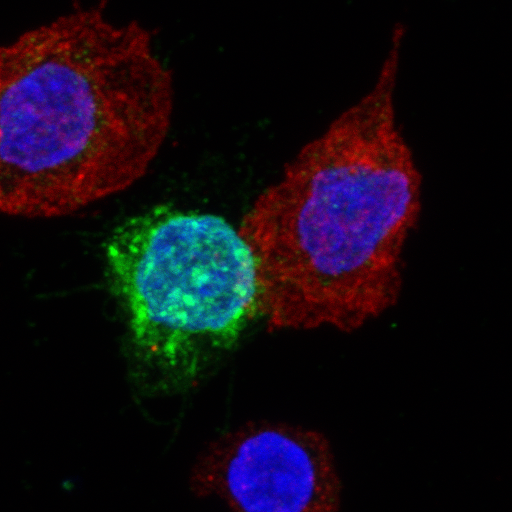 De la recherche à l'industrie Contrôle du VIH les lymphocytes T CD8+ décryptés